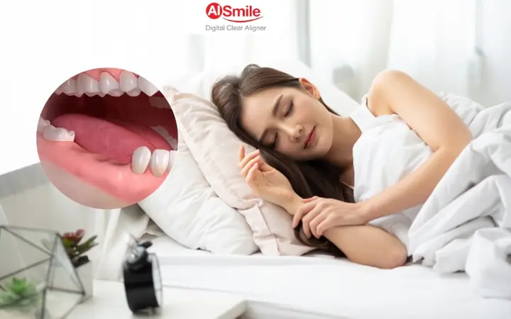 Làm Thế Nào Để Duy Trì Hàm Răng Chắc Khỏe Và Giảm Bớt Căng Thẳng Hằng Ngày? Làm Thế Nào Để Duy Trì Hàm Răng Chắc Khỏe Và Giảm Bớt Căng Thẳng Hằng Ngày?