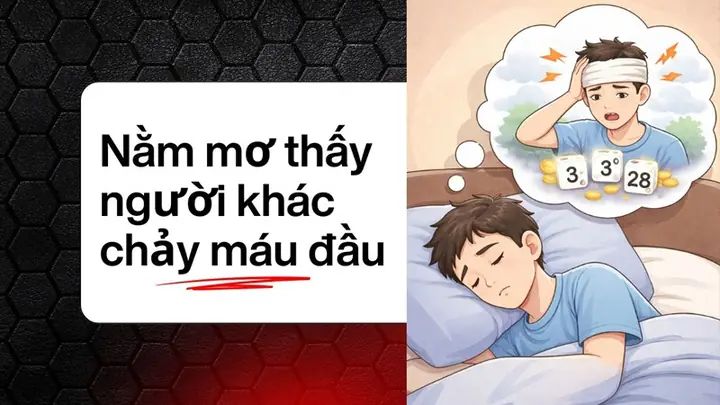 Ngủ Mơ Thấy Người Lạ Chảy Máu Đầu Đánh Số Mấy? Ngủ Mơ Thấy Người Lạ Chảy Máu Đầu Đánh Số Mấy?