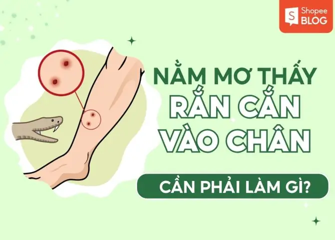 Nằm Mơ Bị Rắn Cắn Là Điềm Báo Gì? Giải Mã Chi Tiết Ý Nghĩa Tốt Hay Xấu Nằm Mơ Bị Rắn Cắn Là Điềm Báo Gì? Giải Mã Chi Tiết Ý Nghĩa Tốt Hay Xấu