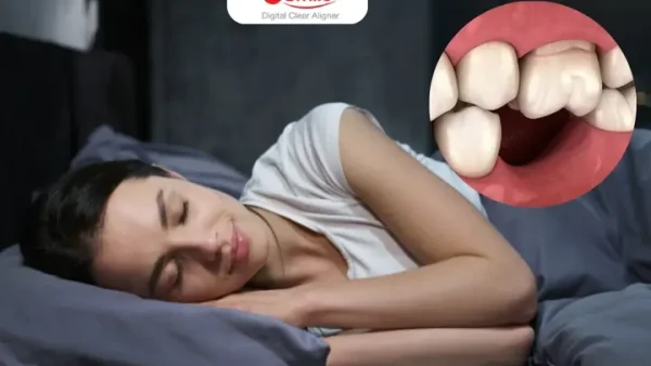 Nằm Mơ Bị Rụng Răng Là Điềm Báo Gì? Giải Mã Giấc Mơ Lành Hay Dữ Dưới Góc Nhìn Khoa Học Và Tâm Linh