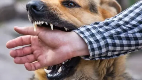 Nằm Mơ Thấy Chó Cắn Vào Chân Đánh Số Gì? Giải Mã Điềm Báo Và Con Số May Mắn