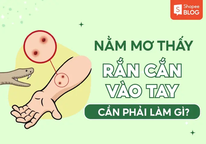 Nằm Mơ Thấy Chó Cắn Vào Tay Không Chảy Máu Là Điềm Báo Gì, Lành Hay Dữ? Nằm Mơ Thấy Chó Cắn Vào Tay Không Chảy Máu Là Điềm Báo Gì, Lành Hay Dữ?