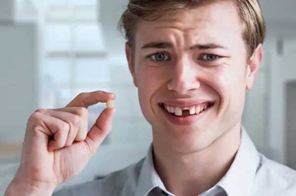 Giấc Mơ Gãy Răng Chảy Máu Mang Ý Nghĩa Điềm Báo Gì Trong Văn Hóa?