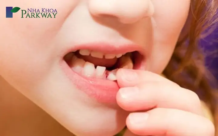 Nằm Mơ Gãy Răng Hàm Dưới Mang Lại Điềm Báo May Mắn Nằm Mơ Gãy Răng Hàm Dưới Mang Lại Điềm Báo May Mắn
