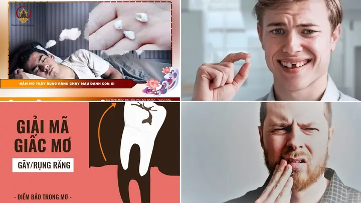 Nằm Mơ Thấy Mình Bị Gãy Chân Mang Điềm Báo Gì Và Đánh Con Số Mấy?