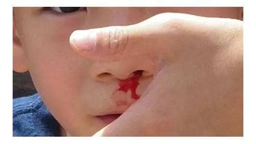 Nằm Mơ Thấy Người Say Rượu Điềm Báo Gì? Giải Mã Ý Nghĩa Và Các Con Số May Mắn