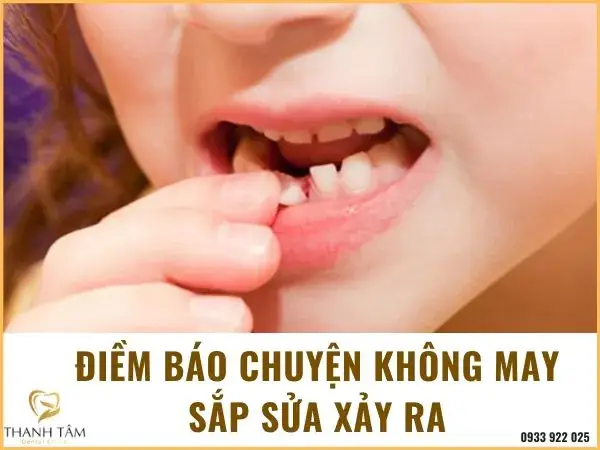 Những Con Số May Mắn Nào Thường Được Gán Cho Giấc Mơ Gãy Răng Hàm Dưới? Những Con Số May Mắn Nào Thường Được Gán Cho Giấc Mơ Gãy Răng Hàm Dưới?