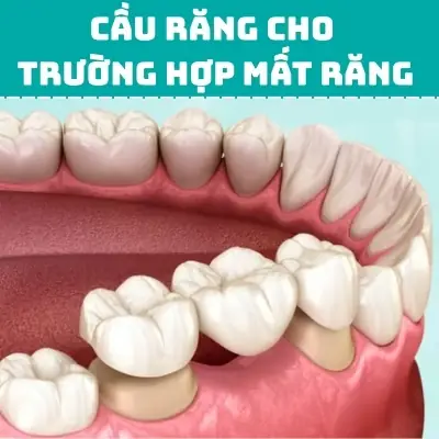 Khi Nào Bạn Cần Đến Gặp Bác Sĩ Nha Khoa Kiểm Tra Sau Giấc Mơ? Khi Nào Bạn Cần Đến Gặp Bác Sĩ Nha Khoa Kiểm Tra Sau Giấc Mơ?