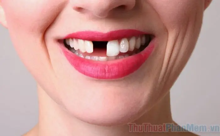 Hình Minh Họa Giấc Mơ Rụng Răng Không Chảy Máu Hình Minh Họa Giấc Mơ Rụng Răng Không Chảy Máu