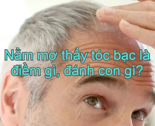 Nằm Mơ Thấy Tóc Bạc Là Điềm Báo Gì? Giải Mã Chi Tiết Ý Nghĩa Lành Dữ Nằm Mơ Thấy Tóc Bạc Là Điềm Báo Gì? Giải Mã Chi Tiết Ý Nghĩa Lành Dữ