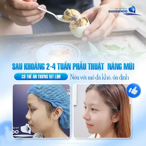 Giấc Mơ Thấy Trứng Vịt Lộn Phản Ánh Tâm Trạng Gì Của Bạn Ngoài Đời Thực?