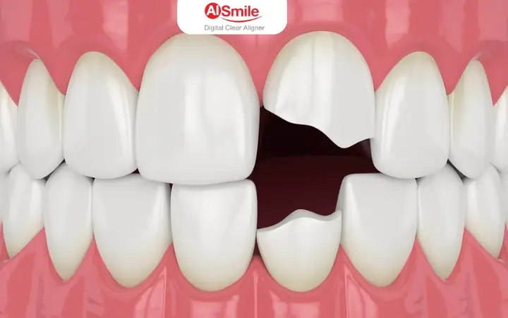 Ngủ Mơ Thấy Rụng Răng Là Điềm Báo Gì? Giải Mã Giấc Mơ Gãy Răng Lành Hay Dữ
