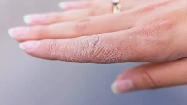 Ngứa Lòng Bàn Tay Phải Là Điềm Báo Gì? Giải Mã May Rủi Và Sức Khỏe