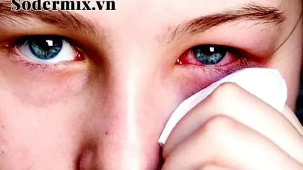 Ngứa Mắt Là Điềm Báo Gì? Giải Mã Điềm Báo Tâm Linh Và Nguyên Nhân Bệnh Lý