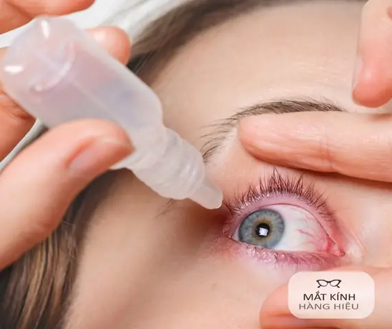 Ngứa Mắt Phải Nữ Là Điềm Gì? Giải Mã Điềm Báo Tâm Linh Và Nguyên Nhân Y Khoa 2027
