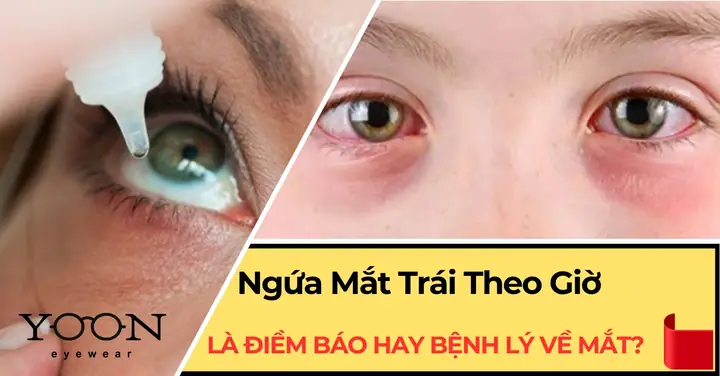 Giải Mã Hiện Tượng Ngứa Mắt Phải Theo Giờ: Điềm Báo Tâm Linh Hay Dấu Hiệu Y Khoa?