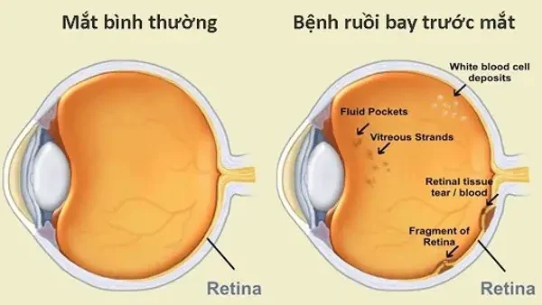 Ruồi Bay Quanh Người Là Điềm Gì? Giải Mã Hiện Tượng Khoa Học Và Tâm Linh