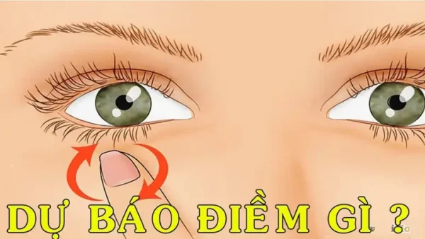 Giải Mã Hiện Tượng Tự Nhiên Nổi Da Gà Ở Tay Là Điềm Gì, Tốt Hay Xấu?