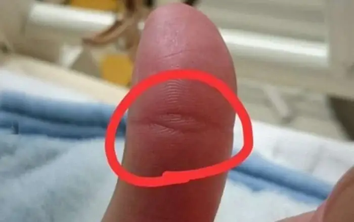 Vân Mắt Phật Trên Ngón Tay Cái Là Gì Và Có Đặc Điểm Nhận Dạng Ra Sao? Vân Mắt Phật Trên Ngón Tay Cái Là Gì Và Có Đặc Điểm Nhận Dạng Ra Sao?
