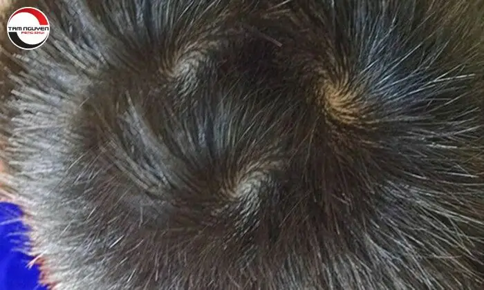 Bói Ý Nghĩa Đốm Trắng Theo Từng Vị Trí Ngón Tay Cụ Thể Bói Ý Nghĩa Đốm Trắng Theo Từng Vị Trí Ngón Tay Cụ Thể